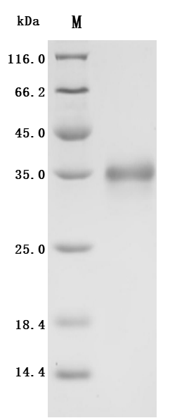SDS-PAGE