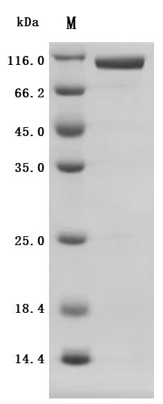 SDS-PAGE