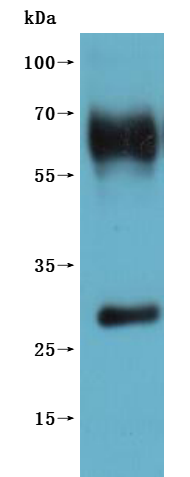 Western Blot