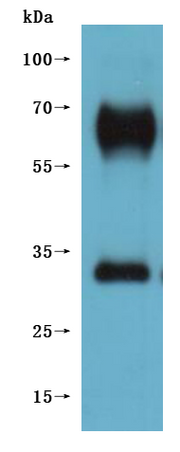 Western Blot