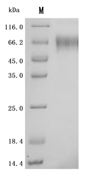 SDS-PAGE