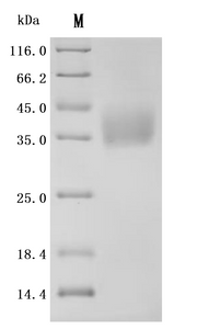SDS-PAGE