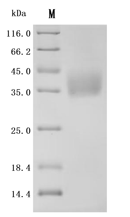SDS-PAGE