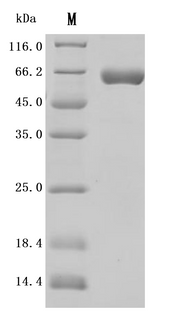 SDS-PAGE
