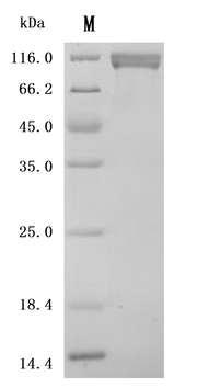 SDS-PAGE