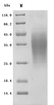 SDS-PAGE