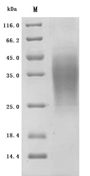 SDS-PAGE