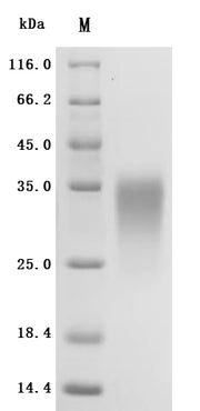 SDS-PAGE