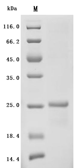 SDS-PAGE