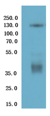 Western Blot