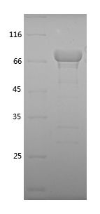 SDS-PAGE