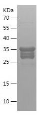 SDS-PAGE