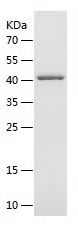 SDS-PAGE