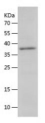 SDS-PAGE