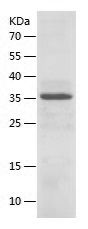 SDS-PAGE