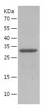 SDS-PAGE