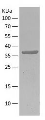 SDS-PAGE