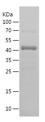 SDS-PAGE