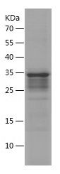 SDS-PAGE