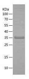 SDS-PAGE