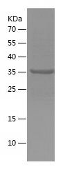 SDS-PAGE