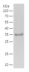 SDS-PAGE