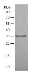 SDS-PAGE