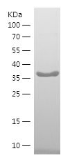 SDS-PAGE