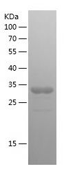 SDS-PAGE