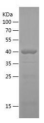 SDS-PAGE