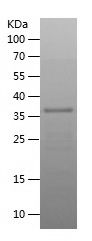 SDS-PAGE