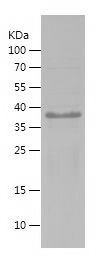 SDS-PAGE