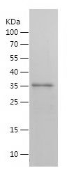 SDS-PAGE