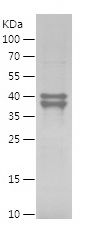 SDS-PAGE