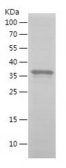 SDS-PAGE