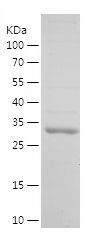 SDS-PAGE