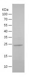 SDS-PAGE