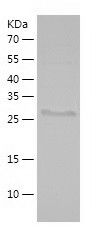 SDS-PAGE