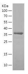 SDS-PAGE