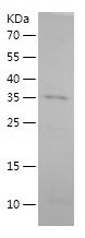 SDS-PAGE