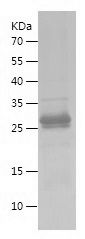 SDS-PAGE