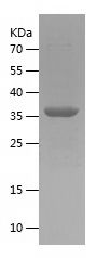 SDS-PAGE