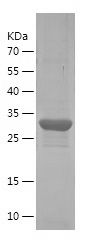 SDS-PAGE