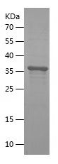 SDS-PAGE