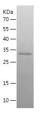 SDS-PAGE