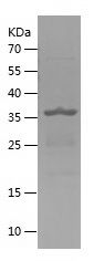 SDS-PAGE