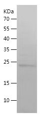 SDS-PAGE
