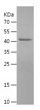SDS-PAGE