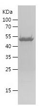 SDS-PAGE