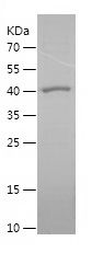 SDS-PAGE
